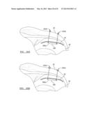 Soft Tissue Repair Device and Associated Methods diagram and image