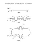 Soft Tissue Repair Device and Associated Methods diagram and image