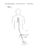 CATHETER INCLUDING CUTTING ELEMENT AND ENERGY EMITTING ELEMENT diagram and image