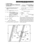 DEVICES FOR MAINTAINING PATENCY OF SURGICALLY CREATED CHANNELS IN TISSUE diagram and image