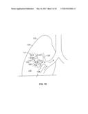 DEVICES FOR MAINTAINING PATENCY OF SURGICALLY CREATED CHANNELS IN TISSUE diagram and image