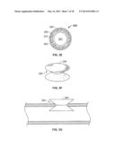 DEVICES FOR MAINTAINING PATENCY OF SURGICALLY CREATED CHANNELS IN TISSUE diagram and image