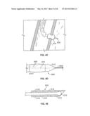DEVICES FOR MAINTAINING PATENCY OF SURGICALLY CREATED CHANNELS IN TISSUE diagram and image