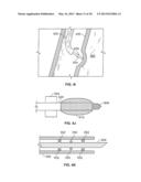 DEVICES FOR MAINTAINING PATENCY OF SURGICALLY CREATED CHANNELS IN TISSUE diagram and image