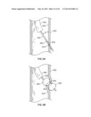 DEVICES FOR MAINTAINING PATENCY OF SURGICALLY CREATED CHANNELS IN TISSUE diagram and image