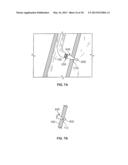 DEVICES FOR MAINTAINING PATENCY OF SURGICALLY CREATED CHANNELS IN TISSUE diagram and image