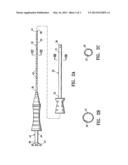 MRI DETECTABLE OBTURATOR diagram and image