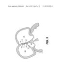 CLOSURE DEVICES, RELATED DELIVERY METHODS AND TOOLS, AND RELATED METHODS     OF USE diagram and image