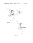 METHOD OF ANCHORING A SUTURE diagram and image