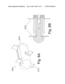 DEVICES AND METHODS FOR THE MINIMALLY INVASIVE TREATMENT OF SPINAL     STENOSIS diagram and image