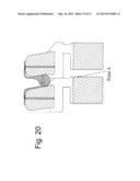 DEVICES AND METHODS FOR THE MINIMALLY INVASIVE TREATMENT OF SPINAL     STENOSIS diagram and image