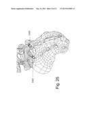 DEVICES AND METHODS FOR THE MINIMALLY INVASIVE TREATMENT OF SPINAL     STENOSIS diagram and image