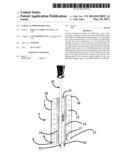 Cervical Spine Retractor diagram and image