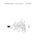 Cervical Spine Retractor diagram and image