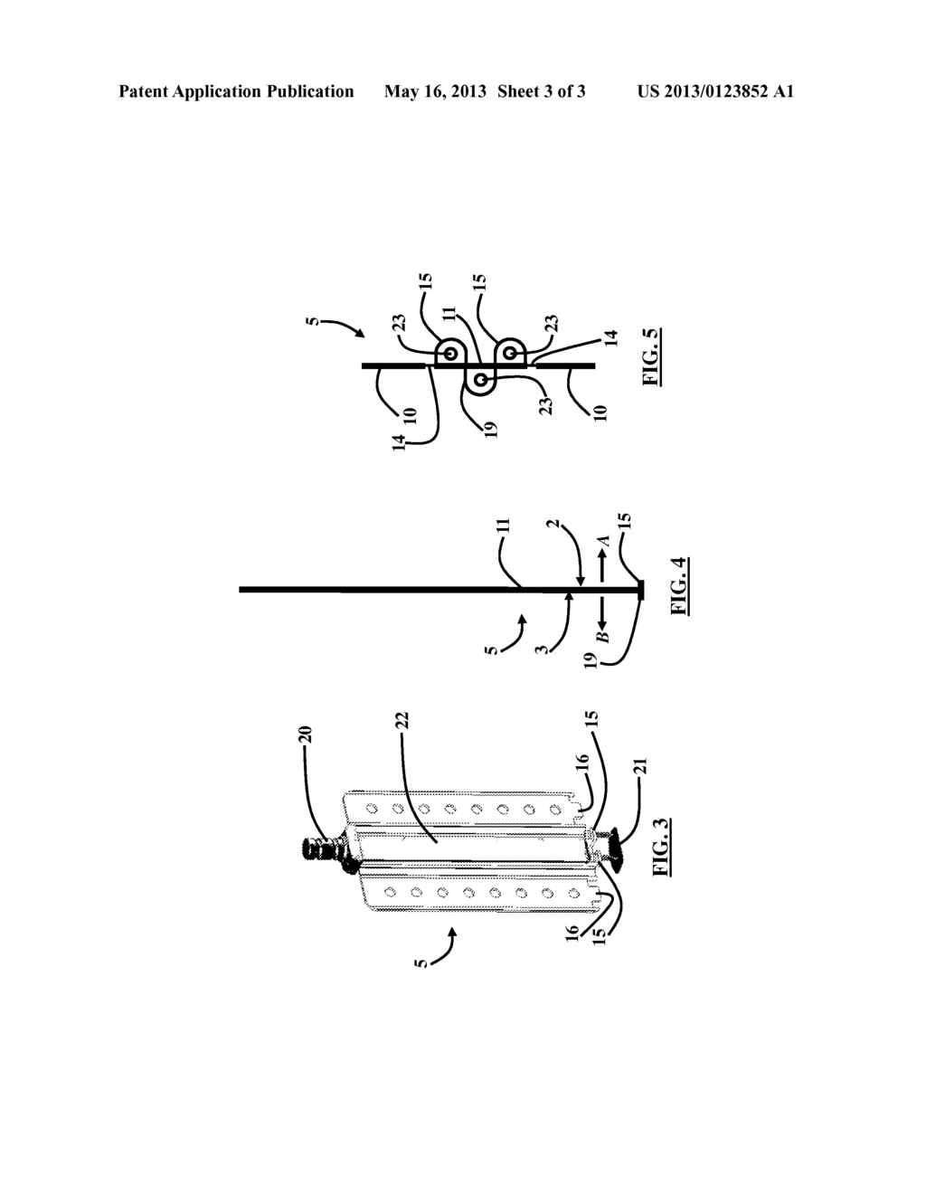 Cervical Spine Retractor - diagram, schematic, and image 04