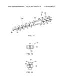 ARTHRODESIS IMPLANT AND BUTTRESSING APPARATUS AND METHOD diagram and image