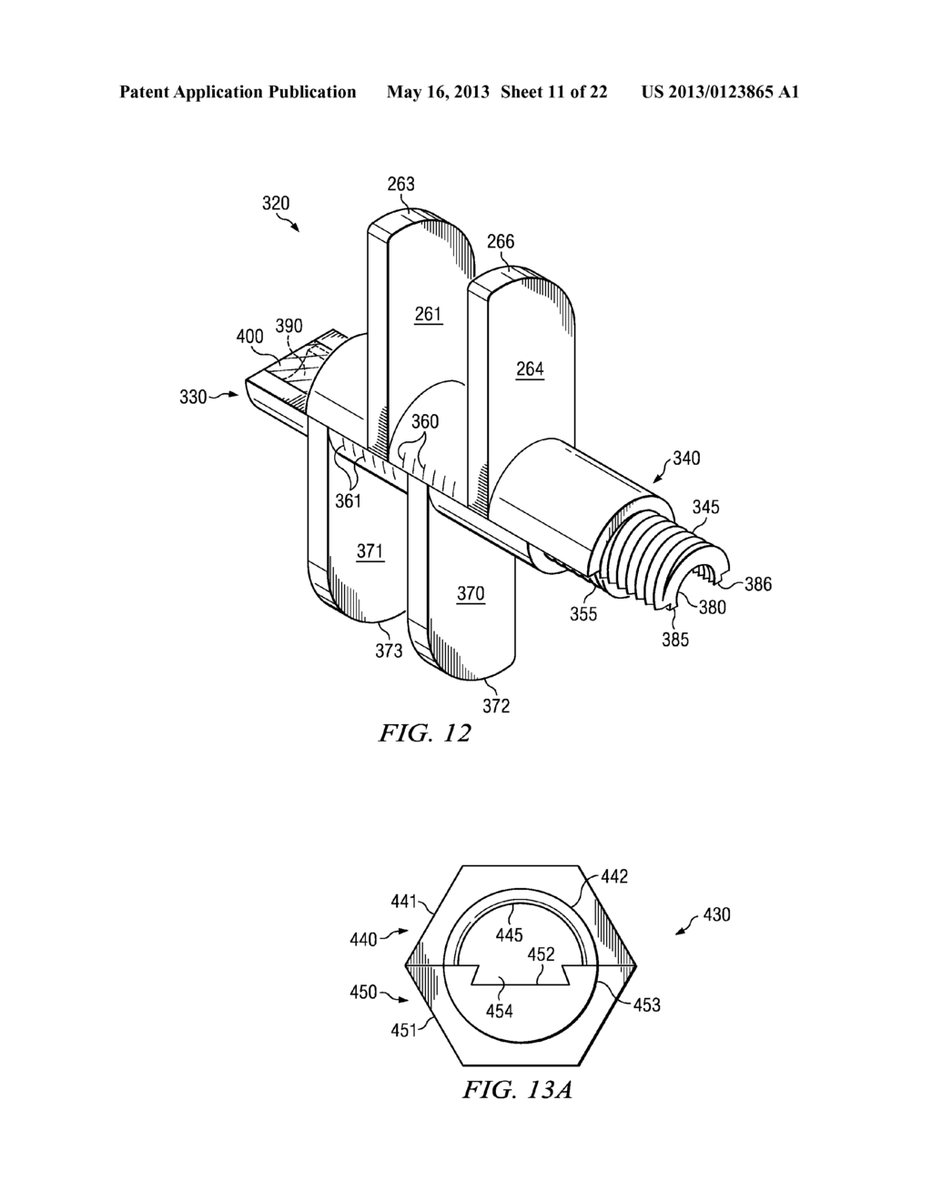 SPONDYLOLISTHESIS CORRECTION APPARATUS AND METHOD - diagram, schematic, and image 12