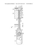 SPONDYLOLISTHESIS CORRECTION APPARATUS AND METHOD diagram and image