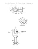 SPONDYLOLISTHESIS CORRECTION APPARATUS AND METHOD diagram and image