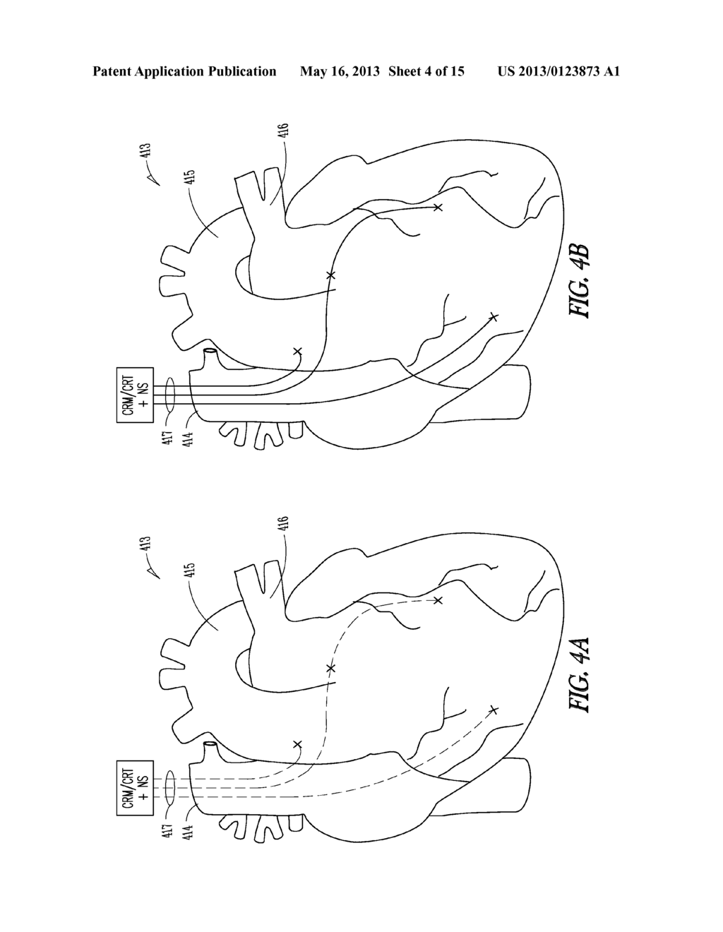 HEART FAILURE MANAGEMENT - diagram, schematic, and image 05