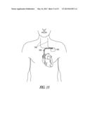 HEART FAILURE MANAGEMENT diagram and image