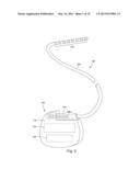 ELECTRICAL STIMULATION LEADS HAVING RF COMPATIBILITY AND METHODS OF USE     AND MANUFACTURE diagram and image