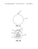 EXTERNAL STEERABLE FIBER FOR USE IN ENDOLUMINAL DEPLOYMENT OF EXPANDABLE     DEVICES diagram and image