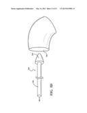 EXTERNAL STEERABLE FIBER FOR USE IN ENDOLUMINAL DEPLOYMENT OF EXPANDABLE     DEVICES diagram and image