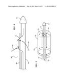 EXTERNAL STEERABLE FIBER FOR USE IN ENDOLUMINAL DEPLOYMENT OF EXPANDABLE     DEVICES diagram and image