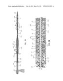 DELIVERY SYSTEMS AND METHODS FOR SHEATHING AND DEPLOYING AN IMPLANTABLE     DEVICE diagram and image