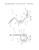 DELIVERY SYSTEMS AND METHODS FOR SHEATHING AND DEPLOYING AN IMPLANTABLE     DEVICE diagram and image