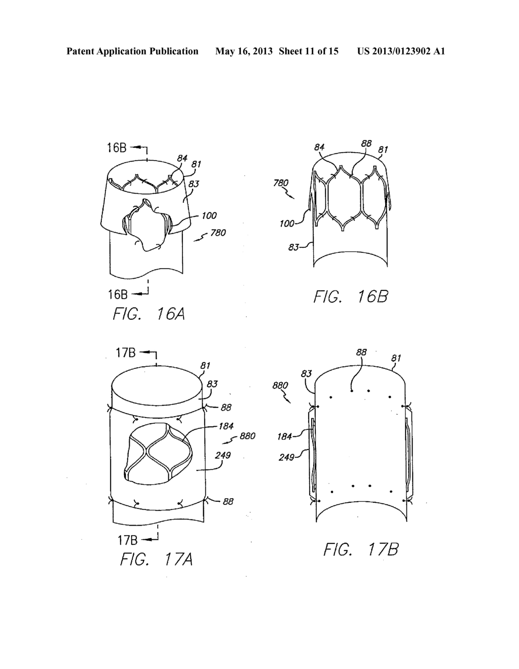 MODULAR GRAFT COMPONENT JUNCTIONS - diagram, schematic, and image 12