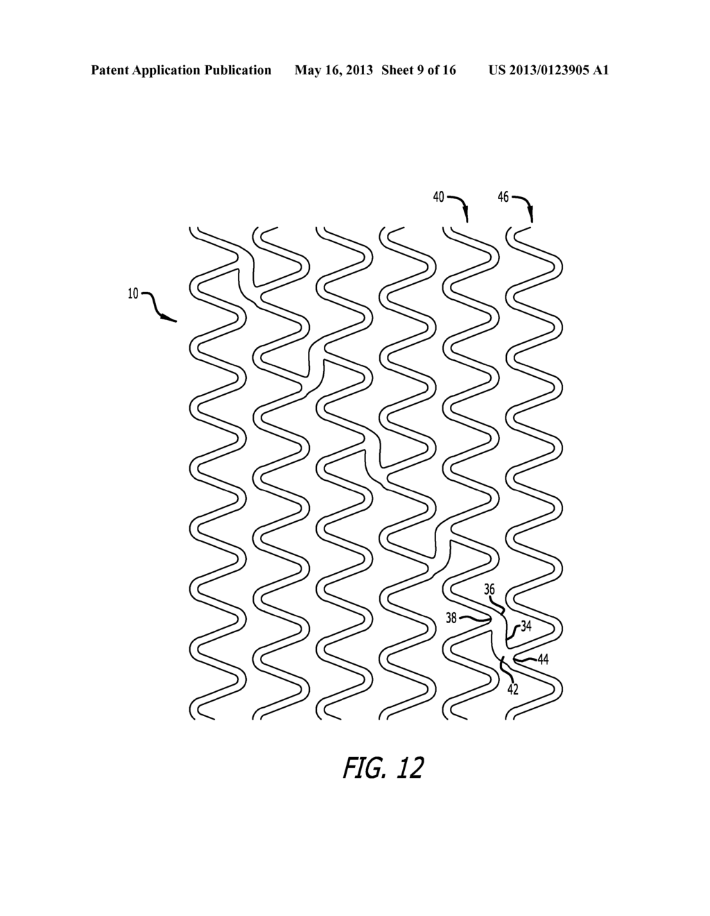 OFFSET PEAK-TO-PEAK STENT PATTERN - diagram, schematic, and image 10