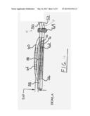 Corneal Implant Storage and Delivery Devices diagram and image