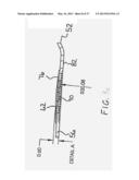 Corneal Implant Storage and Delivery Devices diagram and image