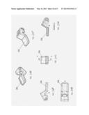 Corneal Implant Storage and Delivery Devices diagram and image