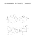 PLASTICALLY DEFORMABLE INTER-OSSEOUS DEVICE diagram and image