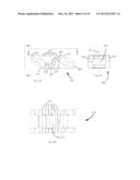 PLASTICALLY DEFORMABLE INTER-OSSEOUS DEVICE diagram and image