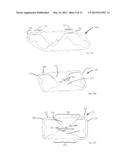 PLASTICALLY DEFORMABLE INTER-OSSEOUS DEVICE diagram and image