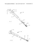 PLASTICALLY DEFORMABLE INTER-OSSEOUS DEVICE diagram and image