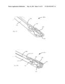 PLASTICALLY DEFORMABLE INTER-OSSEOUS DEVICE diagram and image