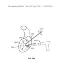 ARTHROSCOPIC TOTAL SHOULDER ARTHROPLASTY diagram and image