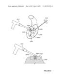 ARTHROSCOPIC TOTAL SHOULDER ARTHROPLASTY diagram and image