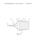 LEAD ASSEMBLY FOR IMPLANTABLE MICROSTIMULATOR diagram and image