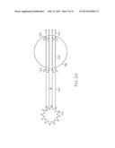 Method And Apparatus For Shockwave Attenuation diagram and image