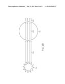 Method And Apparatus For Shockwave Attenuation diagram and image