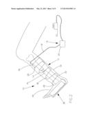 Fracture alignment device diagram and image