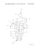 Fracture alignment device diagram and image