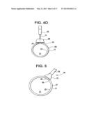 SYSTEMS AND METHODS FOR PUNCTURE CLOSURE diagram and image