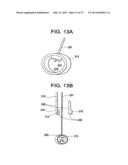 SYSTEMS AND METHODS FOR PUNCTURE CLOSURE diagram and image